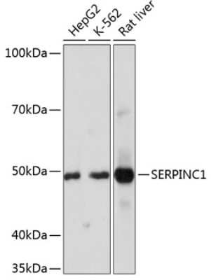 Western Blot: Serpin C1/Antithrombin-III Antibody (2X2V4) [NBP3-15363]