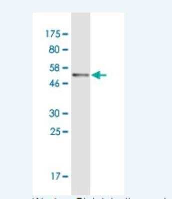 Western Blot: Serpin C1/Antithrombin-III Antibody (3G9) [H00000462-M01]