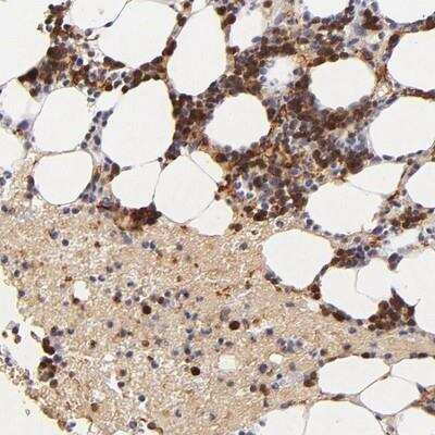 Immunohistochemistry-Paraffin: Serpin C1/Antithrombin-III Antibody [NBP1-90076]