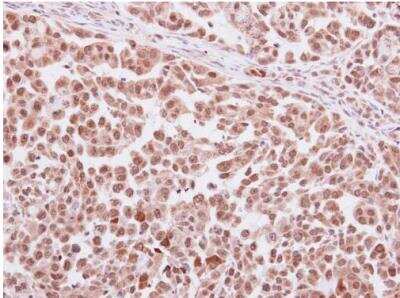 Immunohistochemistry-Paraffin: Serpin C1/Antithrombin-III Antibody [NBP2-15414]