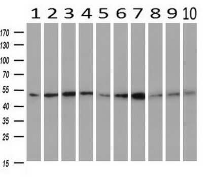 Western Blot: Serpin C1/Antithrombin-III Antibody (OTI8D5)Azide and BSA Free [NBP2-74113]