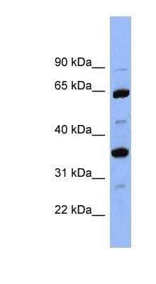 Western Blot: Serpin C1/Antithrombin-III Antibody [NBP1-57918]