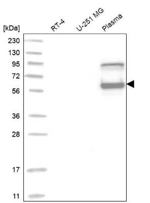 Western Blot: Serpin C1/Antithrombin-III Antibody [NBP1-90077]