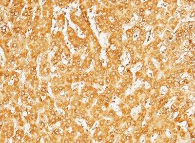 Immunohistochemistry-Paraffin: Serpin D1/Heparin Cofactor II Antibody (008) [NBP2-89392]