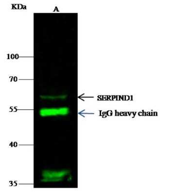 Immunoprecipitation: Serpin D1/Heparin Cofactor II Antibody (25) [NBP2-90429]