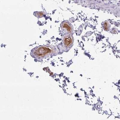 Immunohistochemistry-Paraffin: Serpin D1/Heparin Cofactor II Antibody [NBP2-33764]