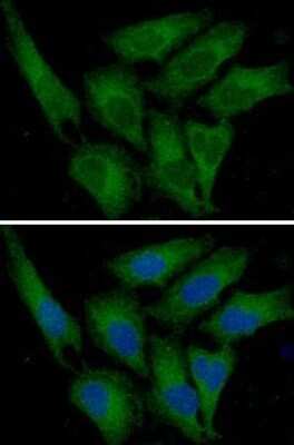 Immunocytochemistry/ Immunofluorescence: Serpin E1/PAI-1 Antibody (1C5) - BSA Free [NBP2-59495]