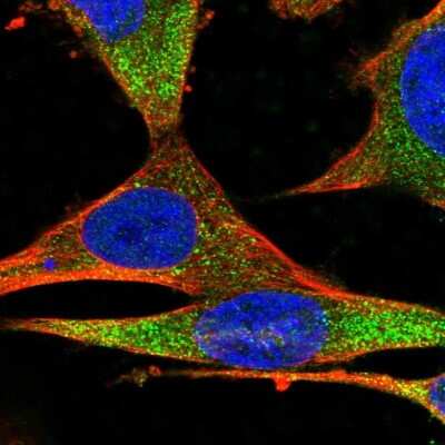 Immunocytochemistry/ Immunofluorescence: Serpin E1/PAI-1 Antibody [NBP2-13298]