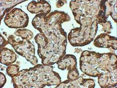 Immunohistochemistry-Paraffin: Serpin E1/PAI-1 Antibody [NB100-1498]