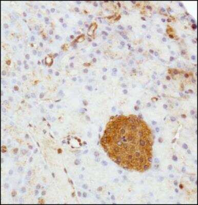 Immunohistochemistry-Paraffin: Serpin E1/PAI-1 Antibody - BSA Free [NBP1-19773]