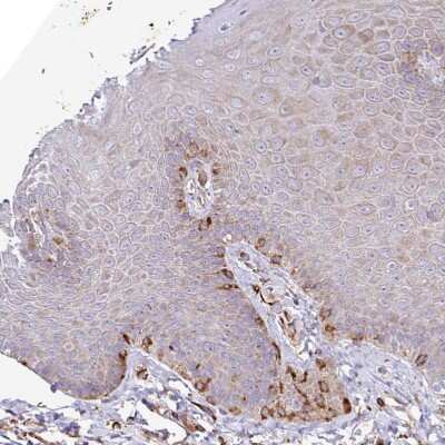 Immunohistochemistry-Paraffin: Serpin E1/PAI-1 Antibody [NBP2-13298]