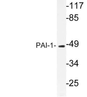Western Blot: Serpin E1/PAI-1 AntibodyBSA Free [NBP1-19773]