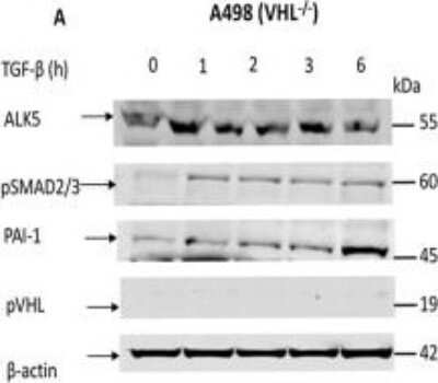 Western Blot: Serpin E1/PAI-1 AntibodyBSA Free [NBP1-19773]