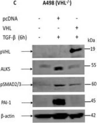 Western Blot: Serpin E1/PAI-1 AntibodyBSA Free [NBP1-19773]