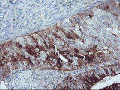 Immunohistochemistry-Paraffin: Serpin E2/PN1 Antibody (OTI2C9) [NBP2-01984]