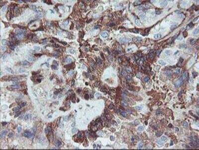 Immunohistochemistry-Paraffin: Serpin E2/PN1 Antibody (OTI2C9) [NBP2-01984]