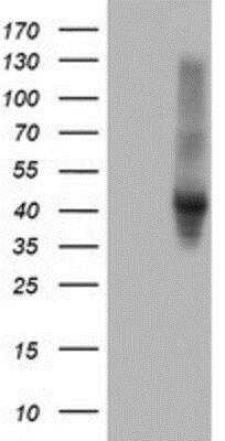 Western Blot: Serpin E2/PN1 Antibody (OTI2C9) [NBP2-01984]