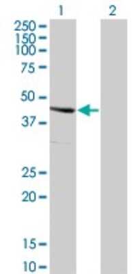 Western Blot: Serpin E2/PN1 Antibody (3G12) [H00005270-M01]