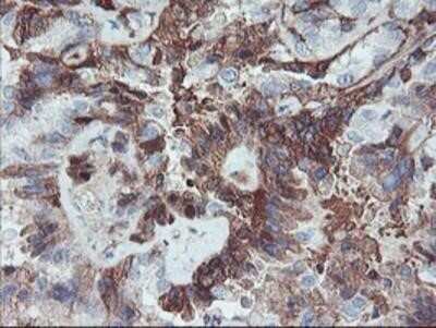 Immunohistochemistry: Serpin E2/PN1 Antibody (OTI2C9) - Azide and BSA Free [NBP2-74117]