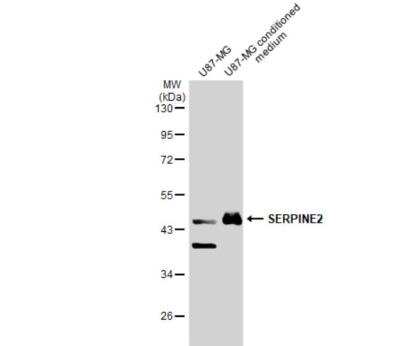 Western Blot: Serpin E2/PN1 Antibody [NBP2-20315]
