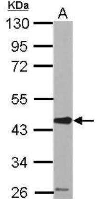 Western Blot: Serpin E2/PN1 Antibody [NBP2-20315]