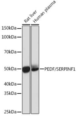 Western Blot: Serpin F1/PEDF Antibody (4H0C5) [NBP3-16195]