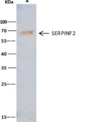Immunoprecipitation: Serpin F2/alpha 2-Antiplasmin Antibody (001) [NBP2-89394]