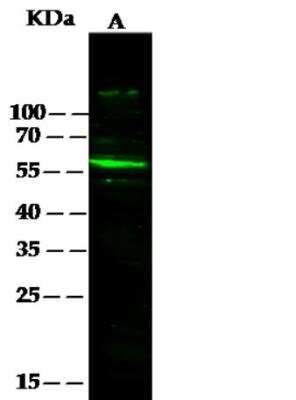 Western Blot: Serpin F2/alpha 2-Antiplasmin Antibody (001) [NBP2-89394]