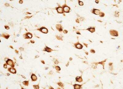 Immunohistochemistry-Paraffin: Serpin F2/alpha 2-Antiplasmin Antibody (043) [NBP2-89397]