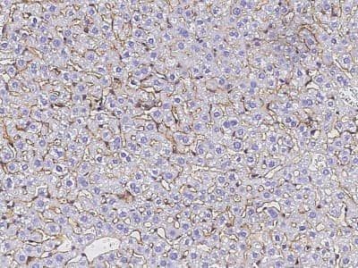 Immunohistochemistry-Paraffin: Serpin F2/alpha 2-Antiplasmin Antibody (128) [NBP2-90459]