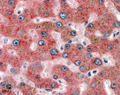 Immunohistochemistry-Paraffin: Serpin F2/alpha 2-Antiplasmin Antibody [NB100-96916]