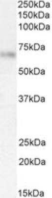 Western Blot: Serpin F2/alpha 2-Antiplasmin Antibody [NB100-96916]