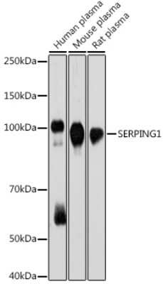 Western Blot: Serpin G1/C1 Inhibitor Antibody (0D3W8) [NBP3-15721]