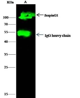 Immunoprecipitation: Serpin G1/C1 Inhibitor Antibody (18) [NBP2-89738]