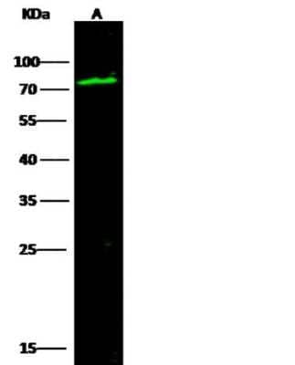 Western Blot: Serpin G1/C1 Inhibitor Antibody (18) [NBP2-89738]