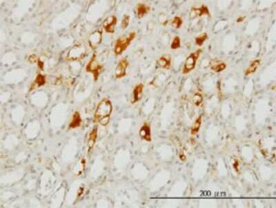 Immunohistochemistry-Paraffin: Serpin G1/C1 Inhibitor Antibody (3F4-1D9) [H00000710-M01]