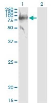 Western Blot: Serpin G1/C1 Inhibitor Antibody (3F4-1D9) [H00000710-M01]