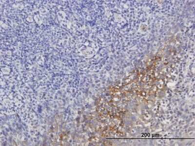 Immunohistochemistry-Paraffin: Serpin G1/C1 Inhibitor Antibody [H00000710-B01P]