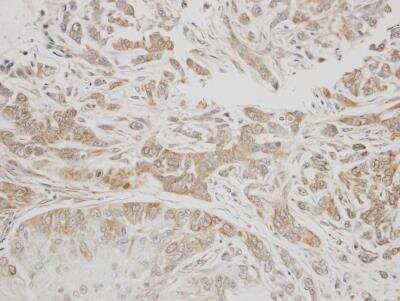 Immunohistochemistry-Paraffin: Serpin G1/C1 Inhibitor Antibody [NBP1-32478]
