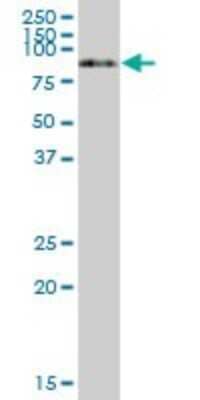 Western Blot: Serpin G1/C1 Inhibitor Antibody [H00000710-B01P]