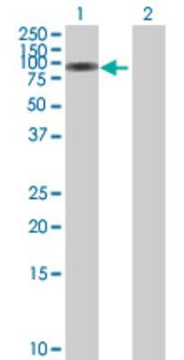 Western Blot: Serpin G1/C1 Inhibitor Antibody [H00000710-B01P]