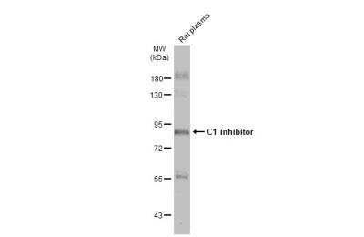 Western Blot: Serpin G1/C1 Inhibitor Antibody [NBP1-32478]