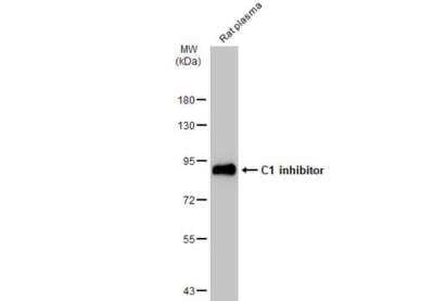 Western Blot: Serpin G1/C1 Inhibitor Antibody [NBP1-32478]