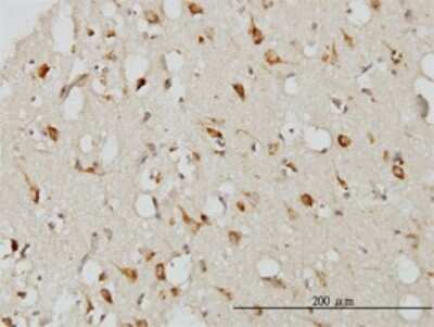 Immunohistochemistry-Paraffin: Serpin I1/Neuroserpin Antibody (1D10) [H00005274-M01]