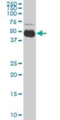 Western Blot: Serpin I1/Neuroserpin Antibody (1E10) [H00005274-M03]