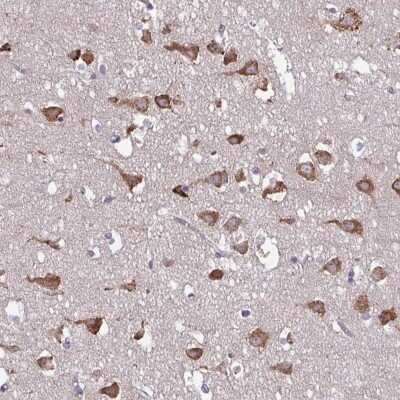 Immunohistochemistry: Serpin I1/Neuroserpin Antibody [NBP2-38784]