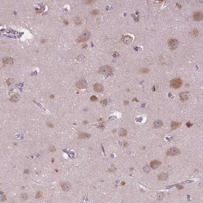 Immunohistochemistry-Paraffin: Serpin I1/Neuroserpin Antibody [NBP1-82587]