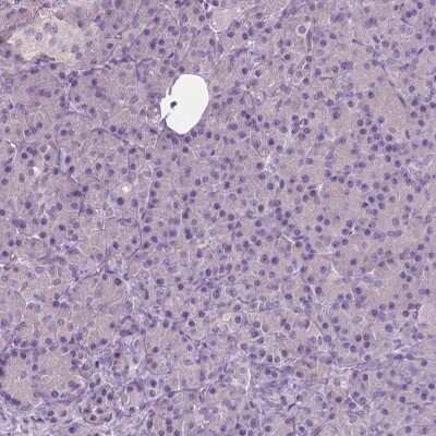Immunohistochemistry-Paraffin: Serpin I1/Neuroserpin Antibody [NBP1-82587]