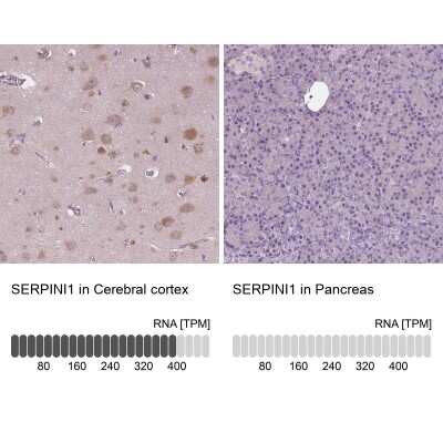 Immunohistochemistry-Paraffin: Serpin I1/Neuroserpin Antibody [NBP1-82587]