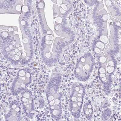 Immunohistochemistry-Paraffin: Serpin I1/Neuroserpin Antibody [NBP2-38784]